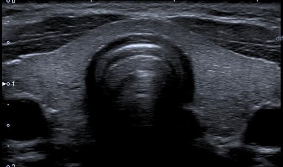 Medical Imaging