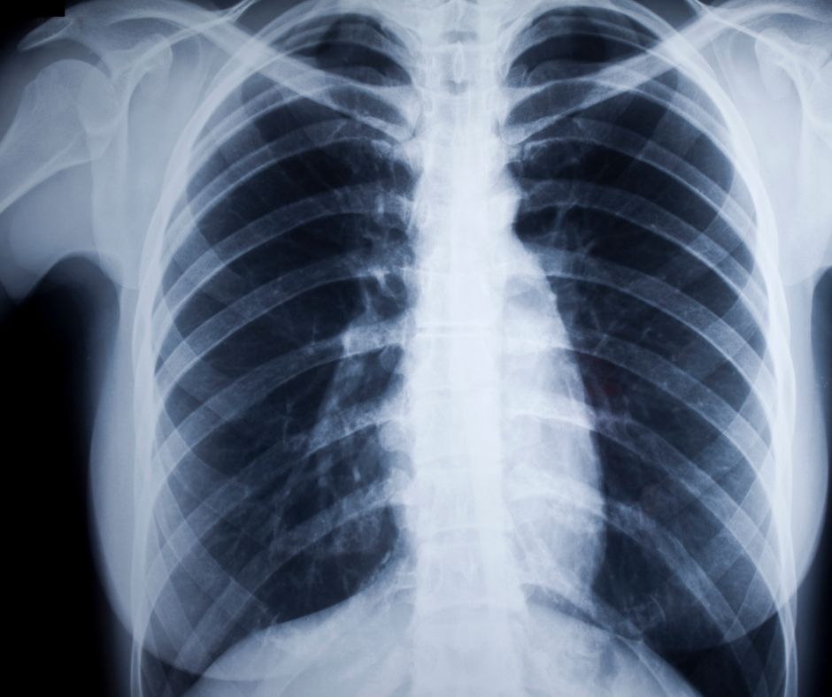 Medical Imaging